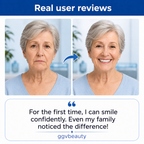 Custom-Fit Dentures for Everyday Comfort