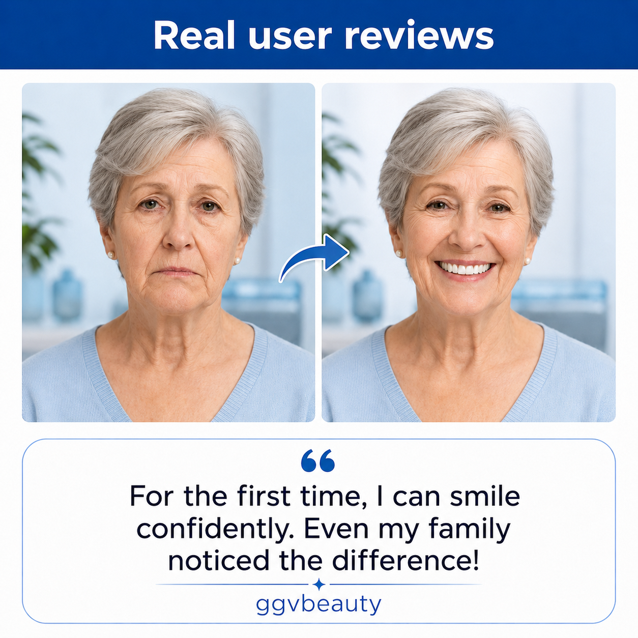 Custom-Fit Dentures for Everyday Comfort