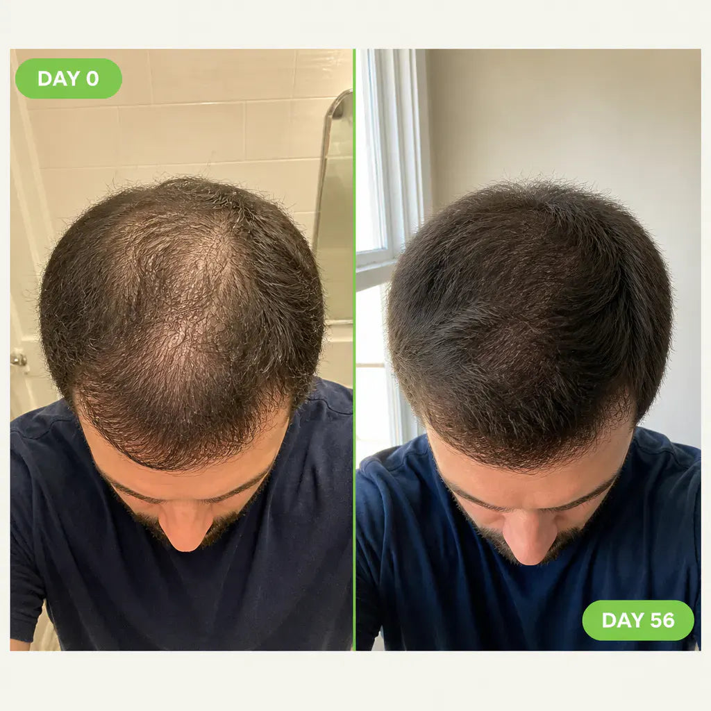 RegrowBar - Men's Hair Growth Shampoo Bar
