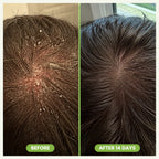 RegrowBar - Men's Hair Growth Shampoo Bar