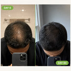RegrowBar - Men's Hair Growth Shampoo Bar