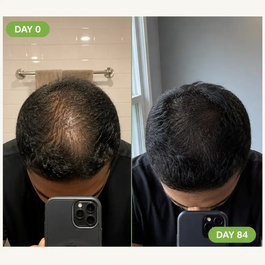 RegrowBar - Men's Hair Growth Shampoo Bar
