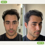 RegrowBar - Men's Hair Growth Shampoo Bar